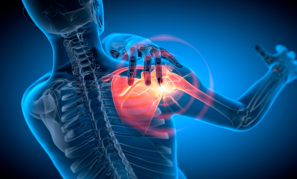 illustrated xray of a person with shoulder pain